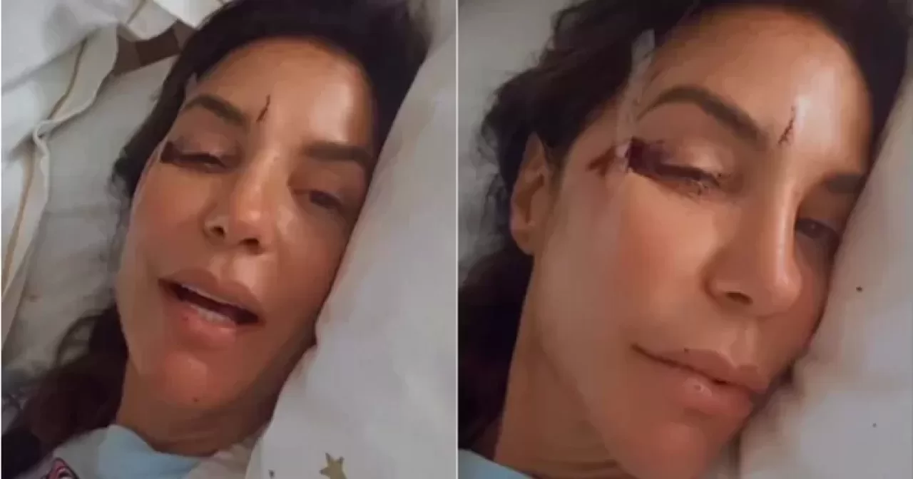 Ivete-Sangalo-e-levada-ao-hospital-apos-sofrer-acidente-domestico.-Reproducao_Instagram-aspect-ratio-40-21